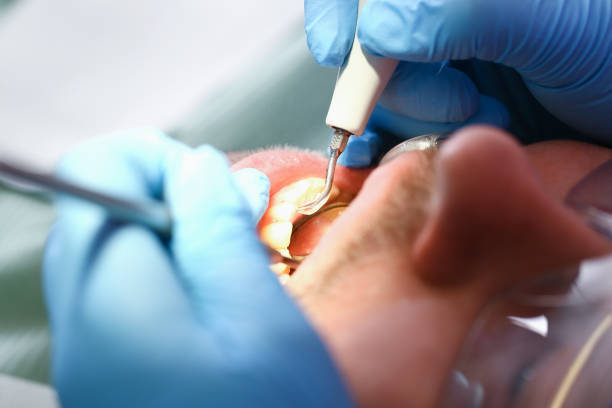 Best Emergency Orthodontic Services in Markham, IL
