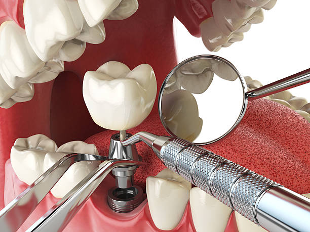 Best Weekend Emergency Dentist in Markham, IL
