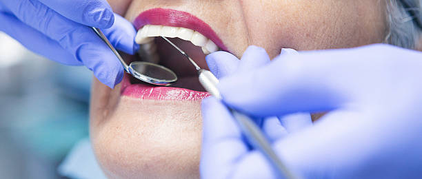 Best Emergency Treatment for Dental Infections or Abscesses in Markham, IL